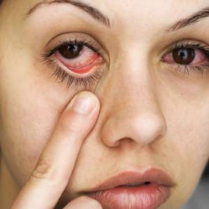general eye problems treatment in lahore